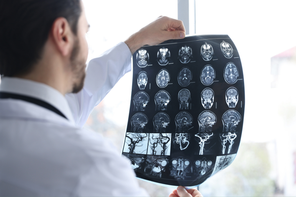 Brain Injuries Marietta, GA 5