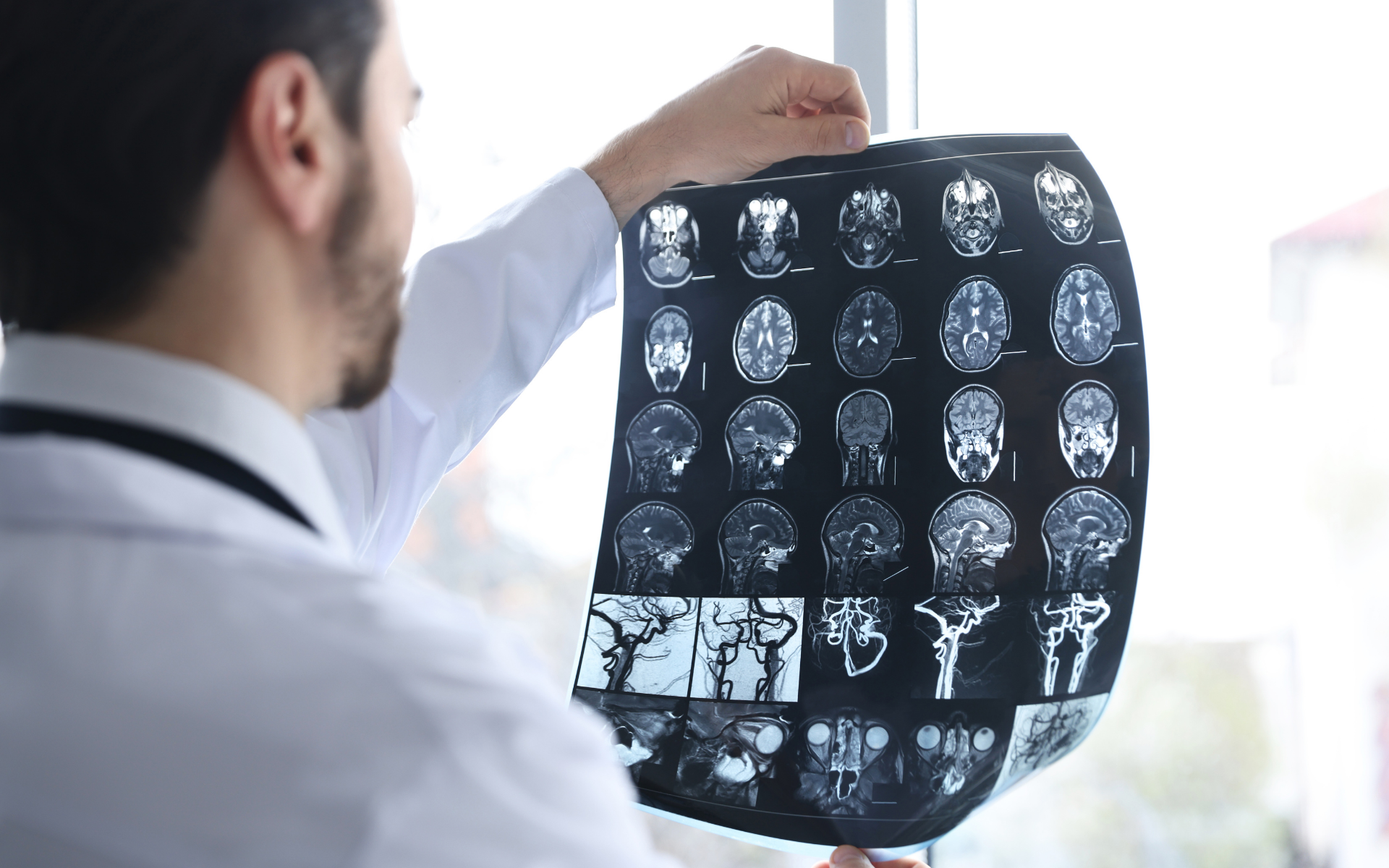 Brain Injuries Dunwoody, GA 2